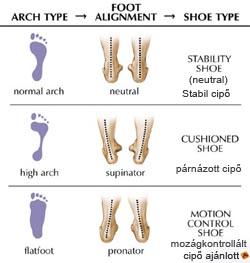lábtípusok, normál, magas boltív, alacsony boltívű lábfej  lúdtalp