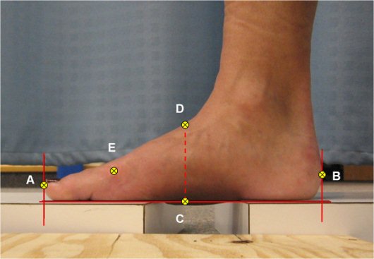 lábfej biomechanikai vizsgálata